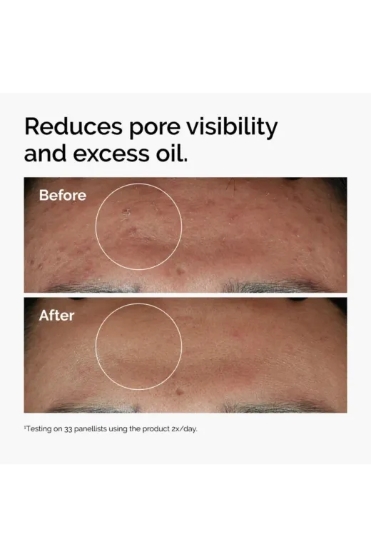 The Ordinary Niacinamide 10% + Zinc 1% - Leke ve Gözenek Görünümü Karşıtı Serum 30ml