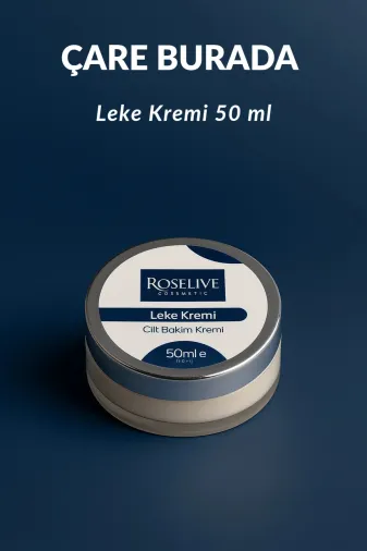 Roselive P4123S1689 - Leke Kremi 50 Ml